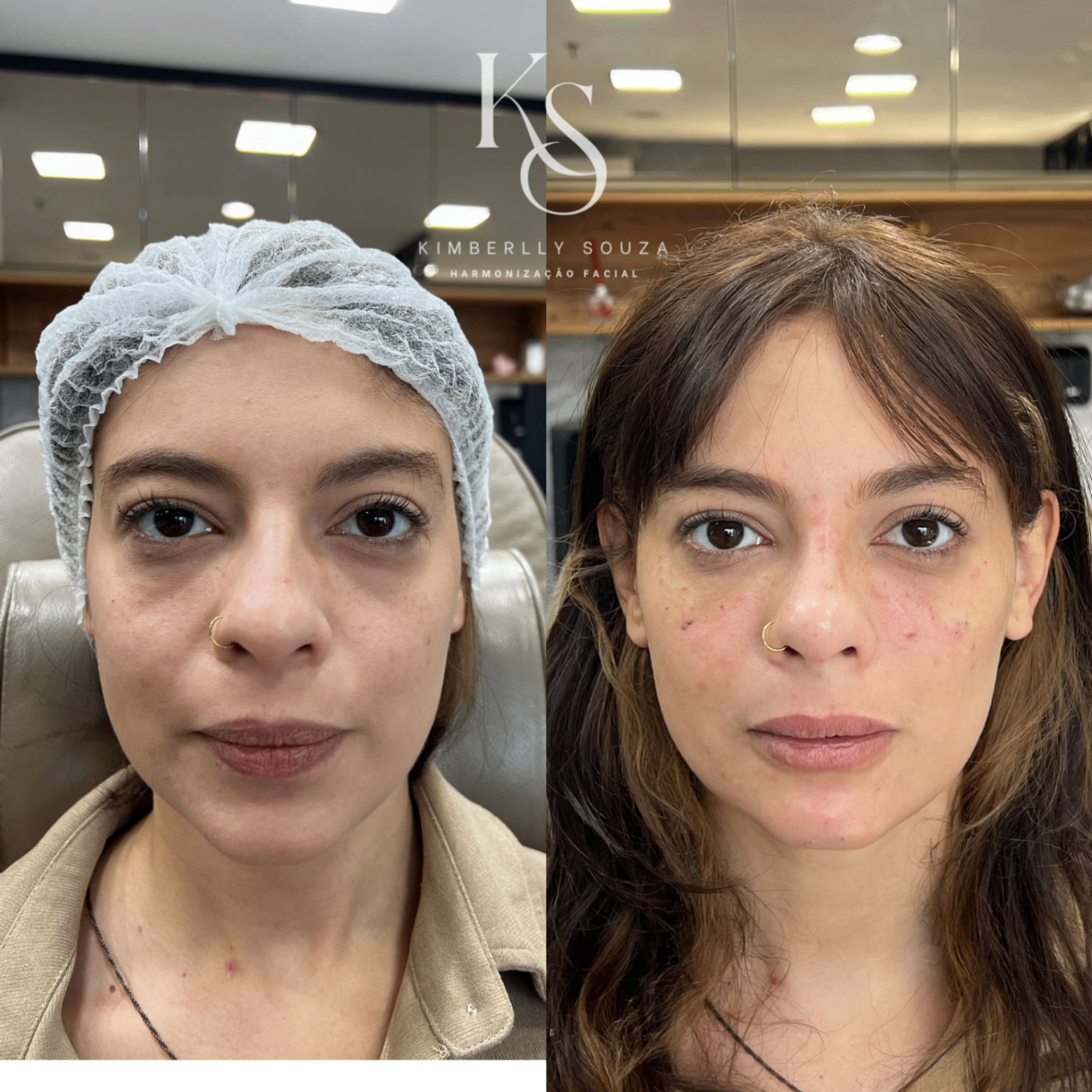 Resultado de tratamento